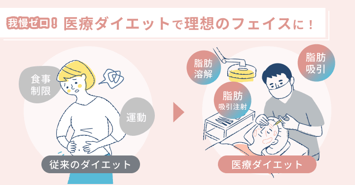 我慢ゼロ!医療ダイエットで理想のフェイスに!